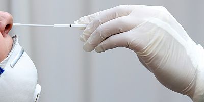 Yeni yöntem Covid-19 testlerinin duyarlılığını 20 kat artırıyor