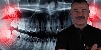 Yirmilik dişler ihmale gelmiyor