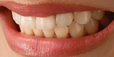 Zihnimizden Dişlerimize İnen Tehlikeye Dikkat 